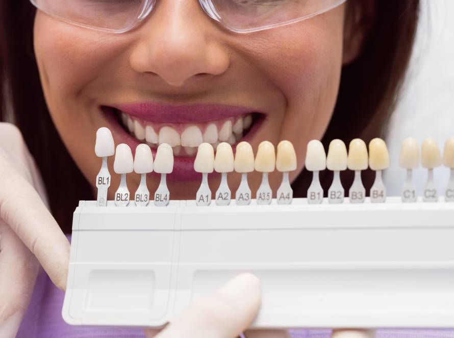 A dentist showing a tooth shade guide next to a smiling patient to match the color for dental crowns or veneers.