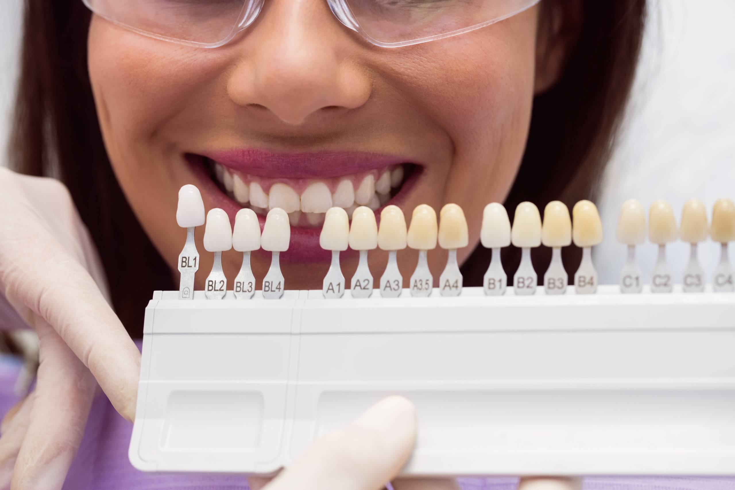 A dentist showing a tooth shade guide next to a smiling patient to match the color for dental crowns or veneers.