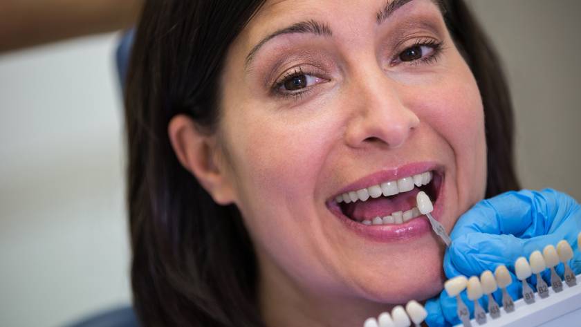 Dentist selecting tooth shade for E-max veneer smile correction treatment