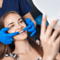 Ceramic Veneers for Chipped, Discoloured and Uneven Teeth
